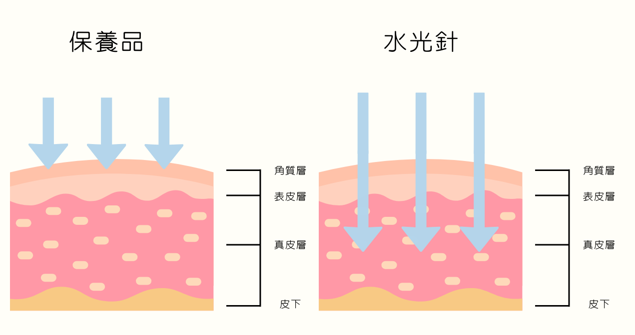 水光針作用原理-肌膚分層構造圖