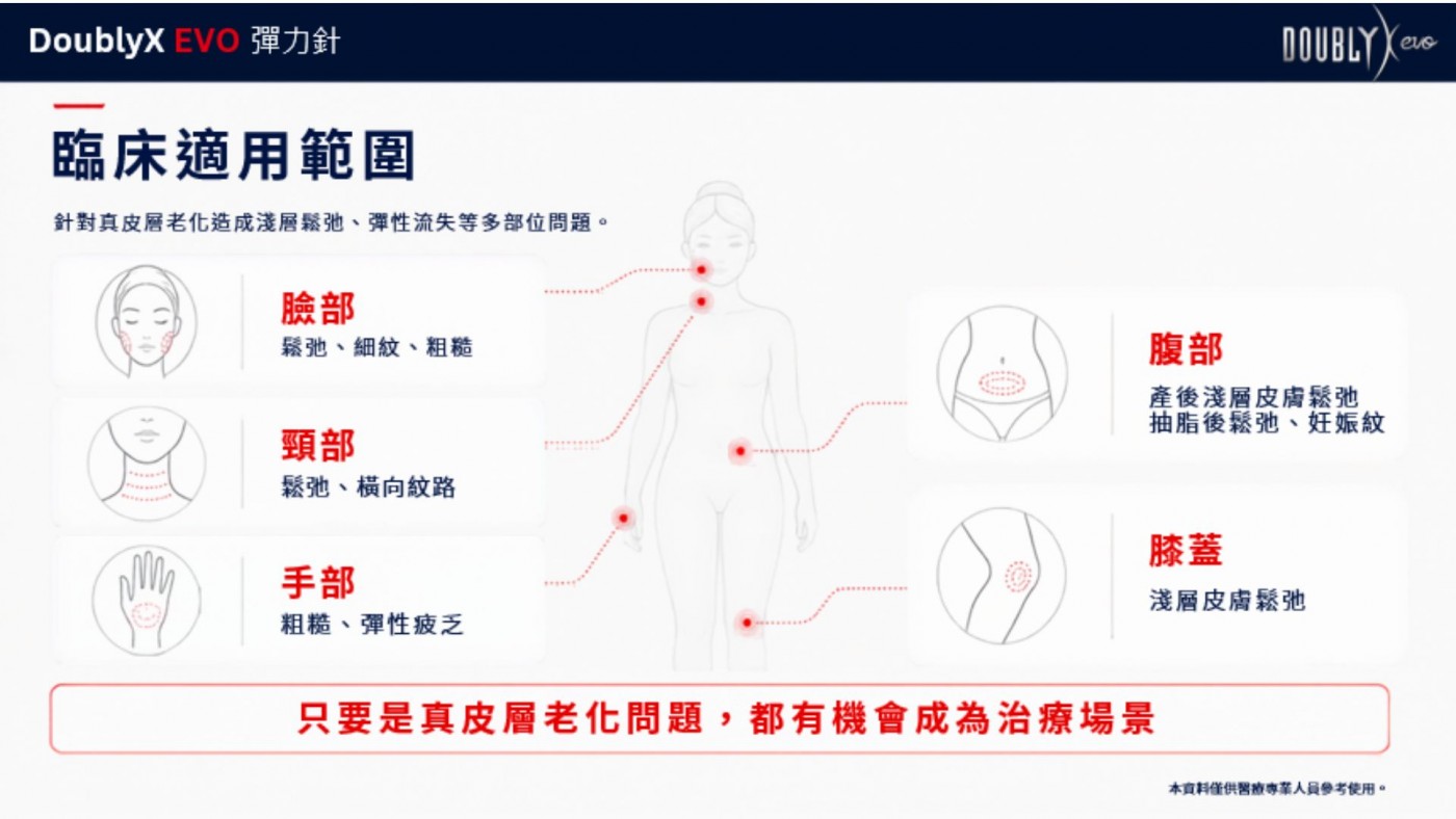 彈力針療程示意